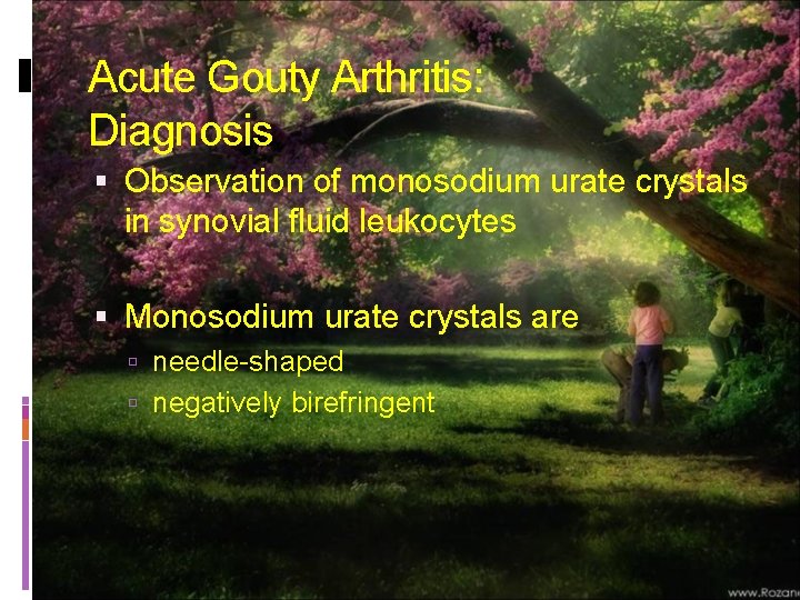 Acute Gouty Arthritis: Diagnosis Observation of monosodium urate crystals in synovial fluid leukocytes Monosodium