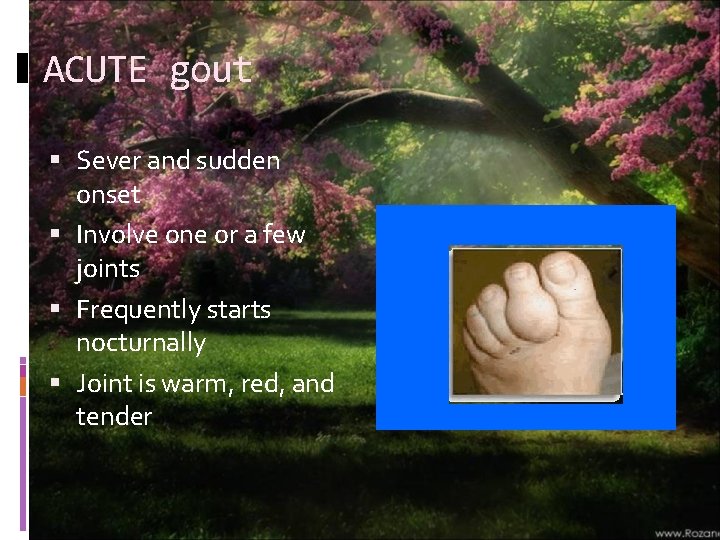 ACUTE gout Sever and sudden onset Involve one or a few joints Frequently starts