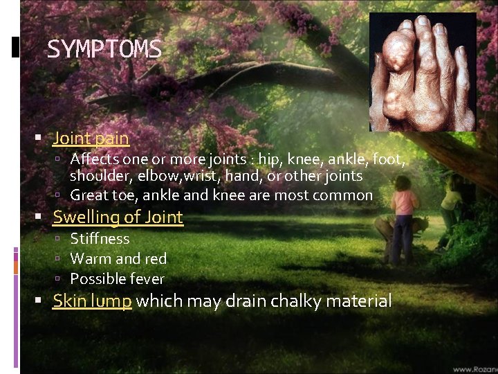 SYMPTOMS Joint pain Affects one or more joints : hip, knee, ankle, foot, shoulder,