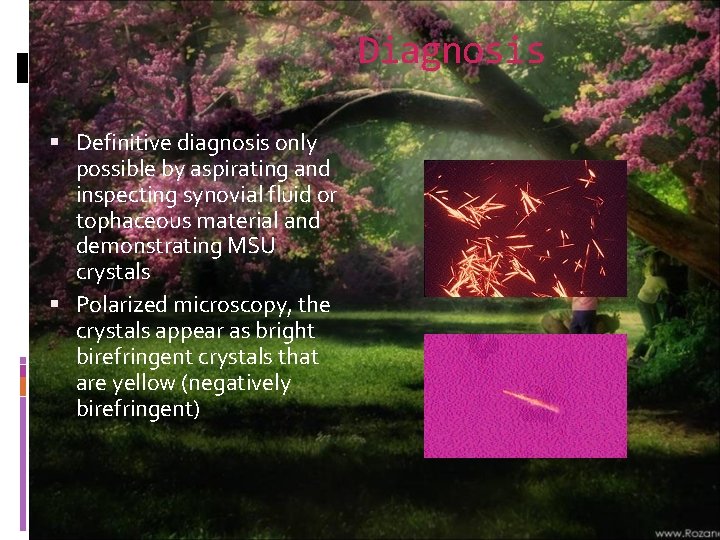 Diagnosis Definitive diagnosis only possible by aspirating and inspecting synovial fluid or tophaceous material