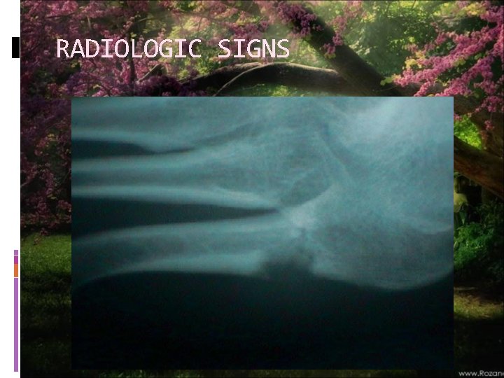 RADIOLOGIC SIGNS 