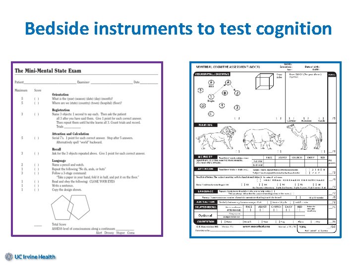 Bedside instruments to test cognition 