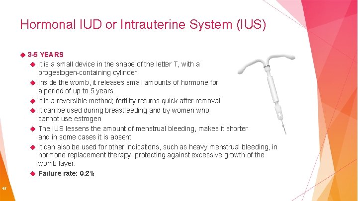 Hormonal IUD or Intrauterine System (IUS) 3 -5 YEARS It is a small device