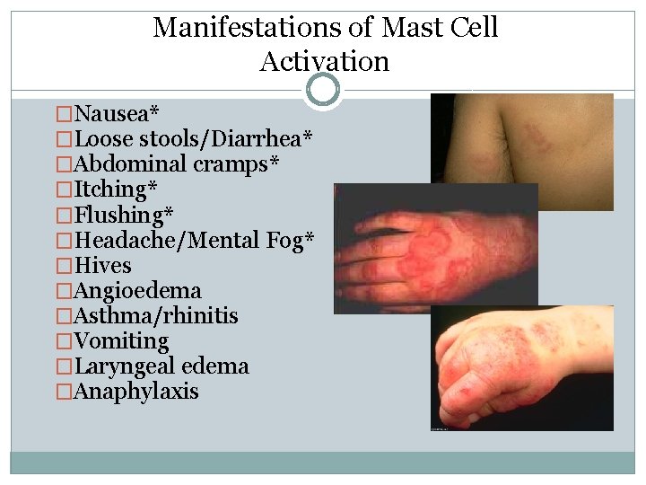 Manifestations of Mast Cell Activation �Nausea* �Loose stools/Diarrhea* �Abdominal cramps* �Itching* �Flushing* �Headache/Mental Fog*