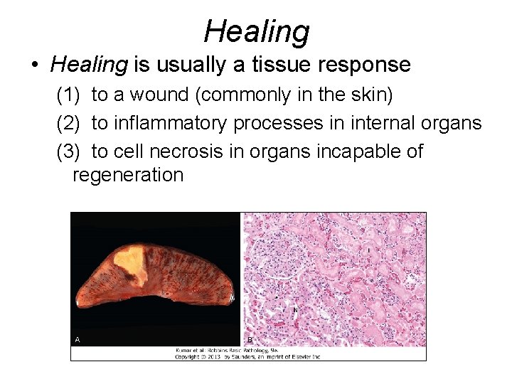Healing • Healing is usually a tissue response (1) to a wound (commonly in