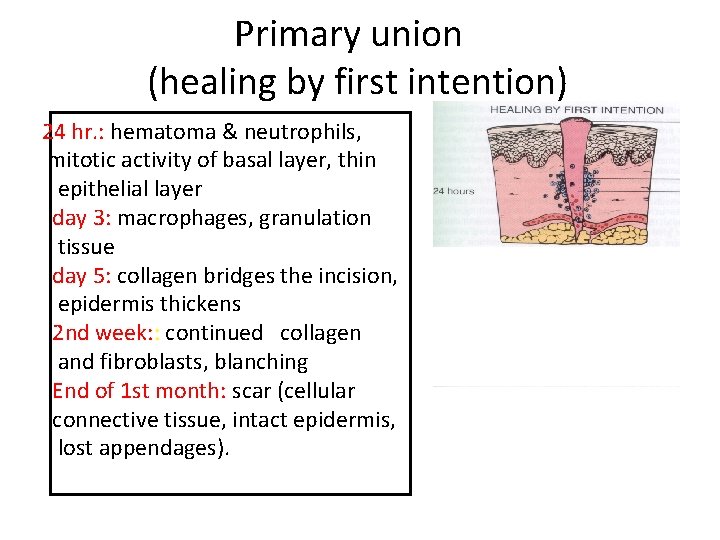 Primary union (healing by first intention) 24 hr. : hematoma & neutrophils, mitotic activity