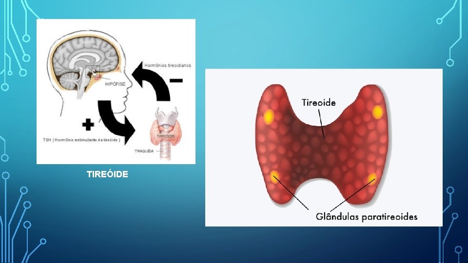 TIREÓIDE 