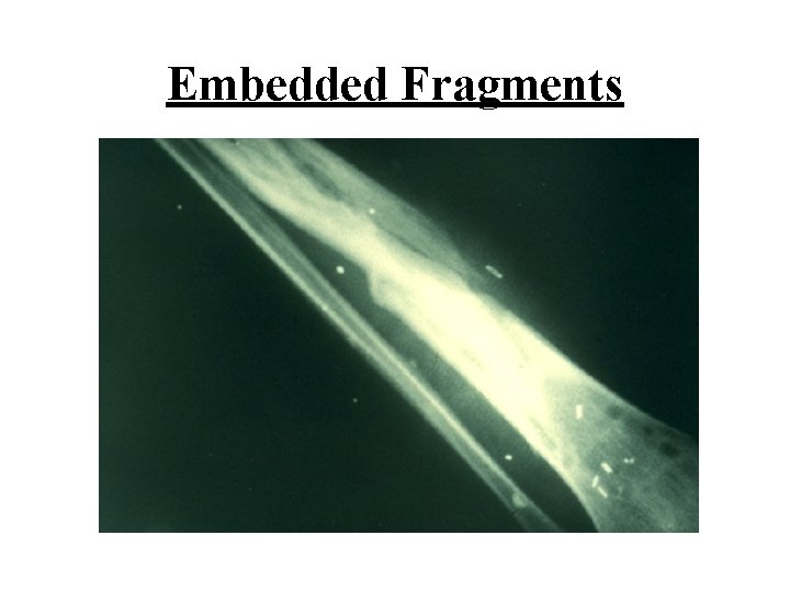 Embedded Fragments 