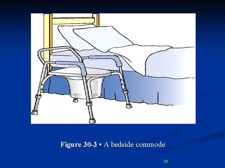 Figure 30 -3 • A bedside commode 20 