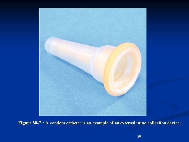 Figure 30 -7 • A condom catheter is an example of an external urine