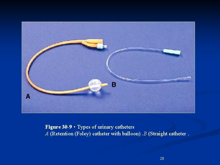 Figure 30 -9 • Types of urinary catheters A (Retention (Foley) catheter with balloon).