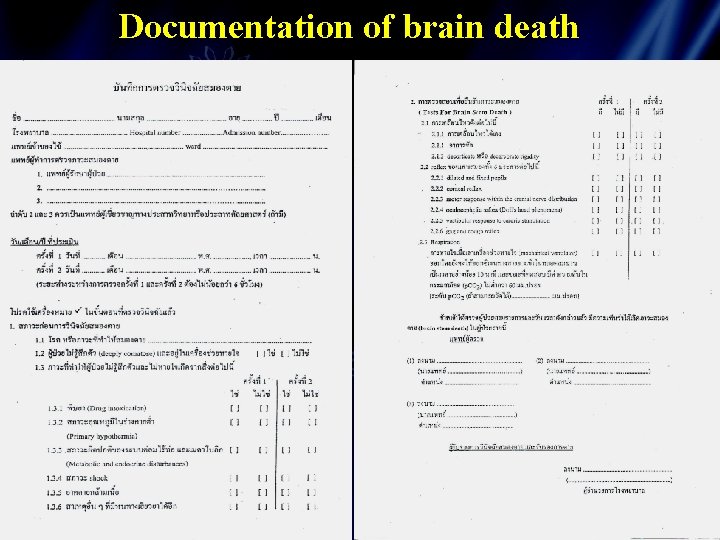 Documentation of brain death 
