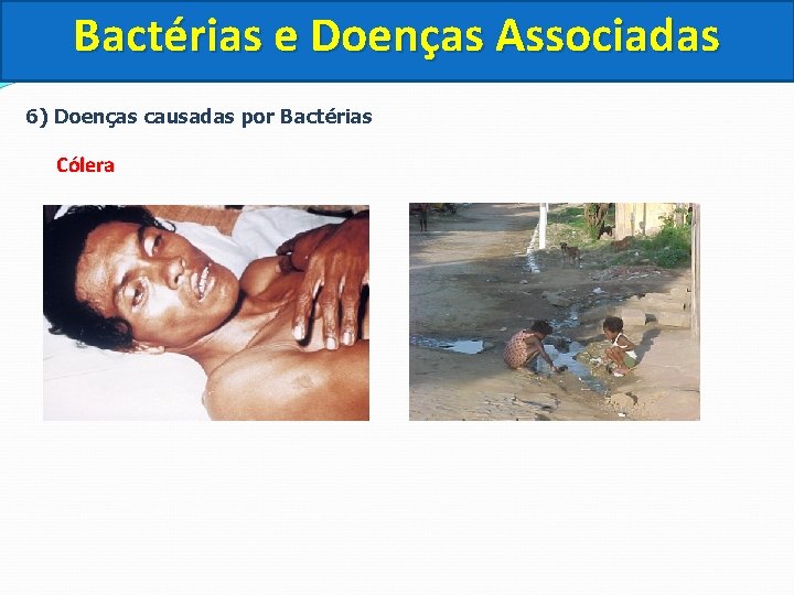 Bactérias e Doenças Associadas 6) Doenças causadas por Bactérias Cólera 