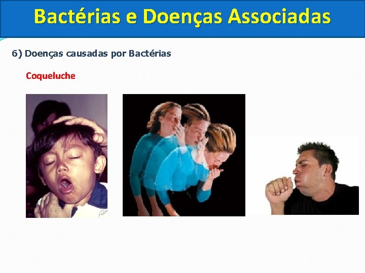 Bactérias e Doenças Associadas 6) Doenças causadas por Bactérias Coqueluche 