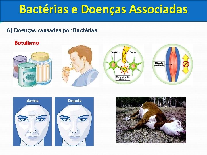 Bactérias e Doenças Associadas 6) Doenças causadas por Bactérias Botulismo 