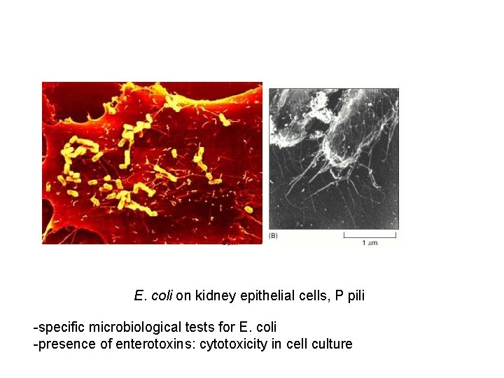 E. coli on kidney epithelial cells, P pili -specific microbiological tests for E. coli