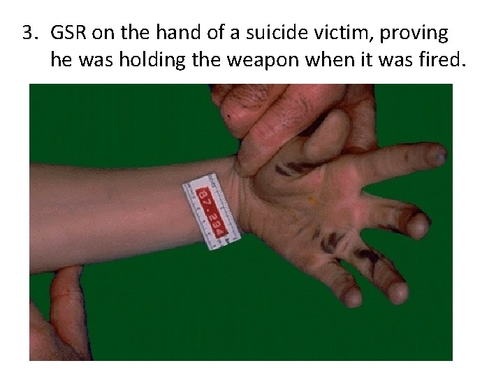 3. GSR on the hand of a suicide victim, proving he was holding the
