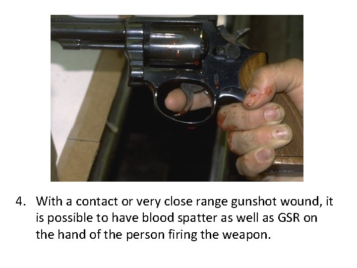 4. With a contact or very close range gunshot wound, it is possible to