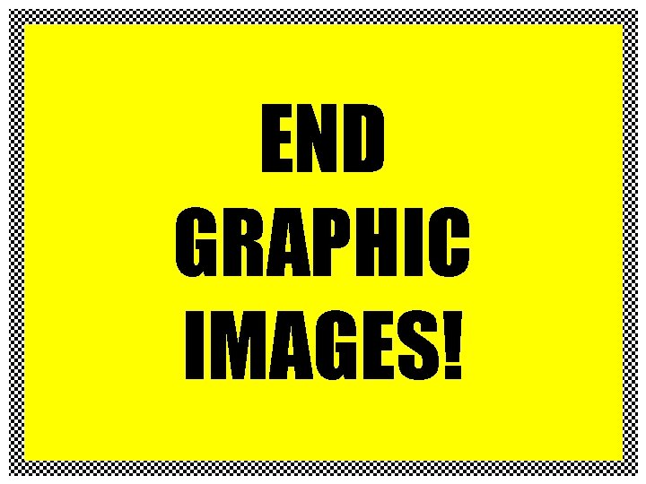 END GRAPHIC IMAGES! 