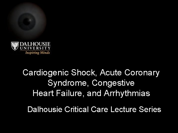 Cardiogenic Shock, Acute Coronary Syndrome, Congestive Heart Failure, and Arrhythmias Dalhousie Critical Care Lecture