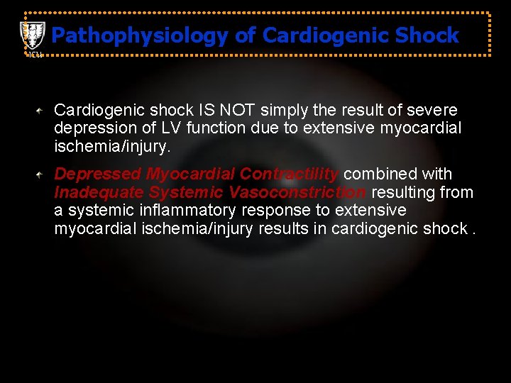 Pathophysiology of Cardiogenic Shock ICU Cardiogenic shock IS NOT simply the result of severe