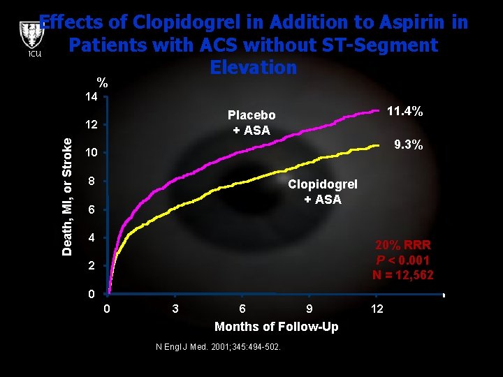 Effects of Clopidogrel in Addition to Aspirin in Patients with ACS without ST-Segment ICU