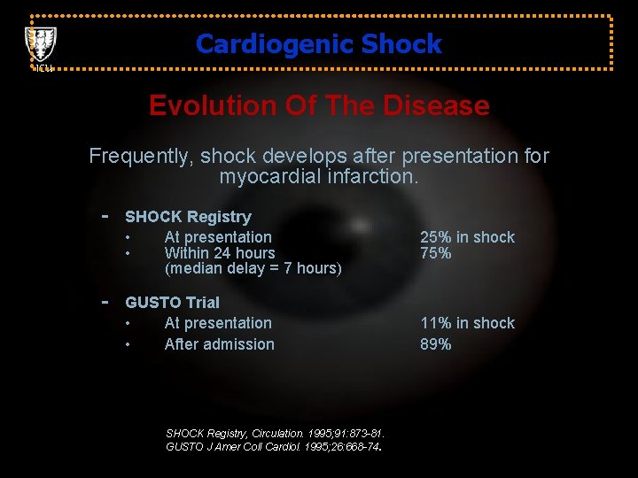 Cardiogenic Shock ICU Evolution Of The Disease Frequently, shock develops after presentation for myocardial