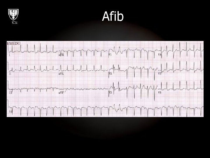 ICU Afib 