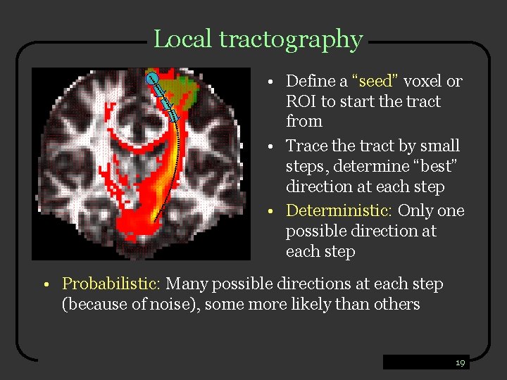 Local tractography • Define a “seed” voxel or ROI to start the tract from