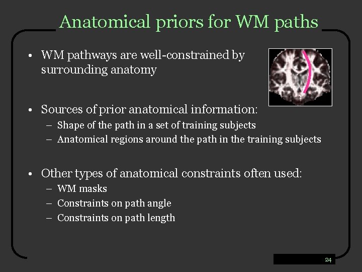 Anatomical priors for WM paths • WM pathways are well-constrained by surrounding anatomy •