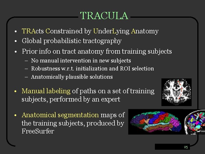 TRACULA • TRActs Constrained by Under. Lying Anatomy • Global probabilistic tractography • Prior