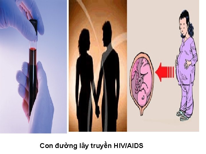 Con đường lây truyền HIV/AIDS 