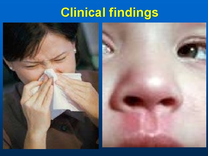 Clinical findings 