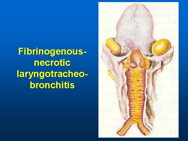 Fibrinogenousnecrotic laryngotracheobronchitis 