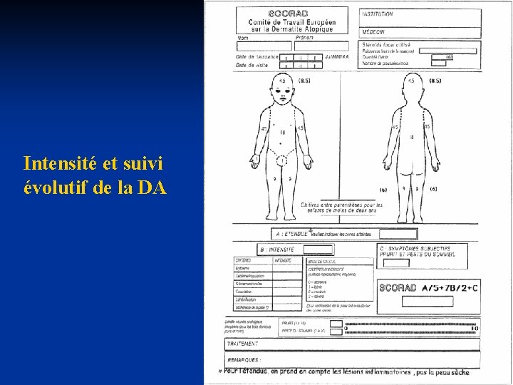 Intensité et suivi évolutif de la DA Intensité et suivi évolutif de la DA