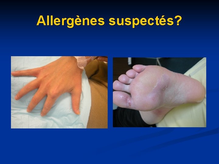Allergènes suspectés? Allergènes suspectés?