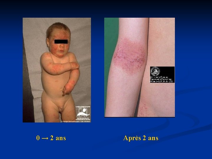0 → 2 ans Après 2 ans 0 → 2 ans Après 2 ans