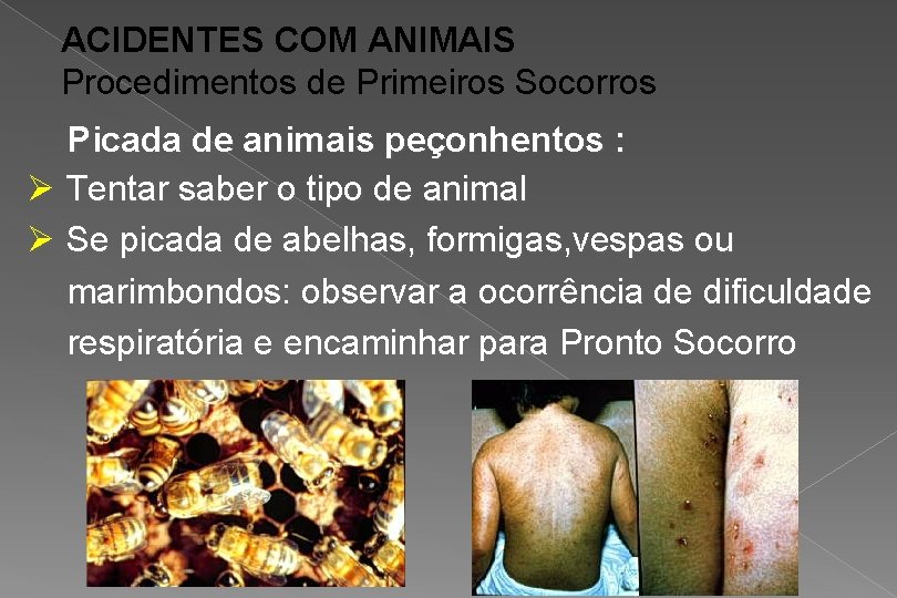 ACIDENTES COM ANIMAIS Procedimentos de Primeiros Socorros Picada de animais peçonhentos : Ø Tentar
