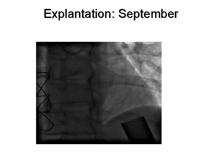 Explantation: September 