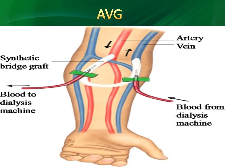 AVG 