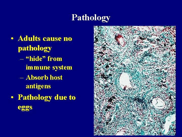 Pathology • Adults cause no pathology – “hide” from immune system – Absorb host