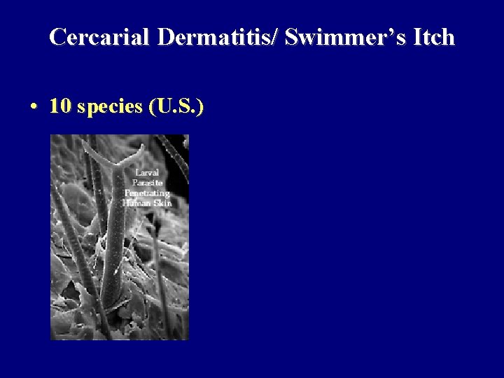 Cercarial Dermatitis/ Swimmer’s Itch • 10 species (U. S. ) 