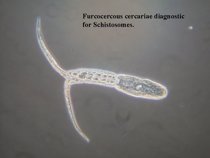 Furcocercous cercariae diagnostic for Schistosomes. 