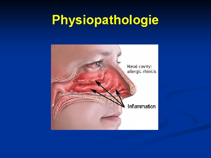 Physiopathologie Physiopathologie