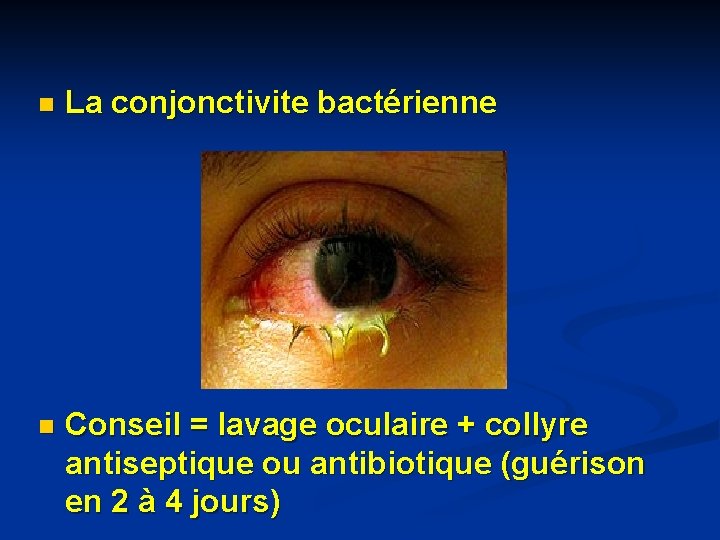 n La conjonctivite bactérienne n Conseil = lavage oculaire + collyre antiseptique ou antibiotique n La conjonctivite bactérienne n Conseil = lavage oculaire + collyre antiseptique ou antibiotique