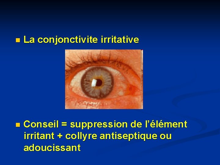 n La conjonctivite irritative n Conseil = suppression de l’élément irritant + collyre antiseptique n La conjonctivite irritative n Conseil = suppression de l’élément irritant + collyre antiseptique