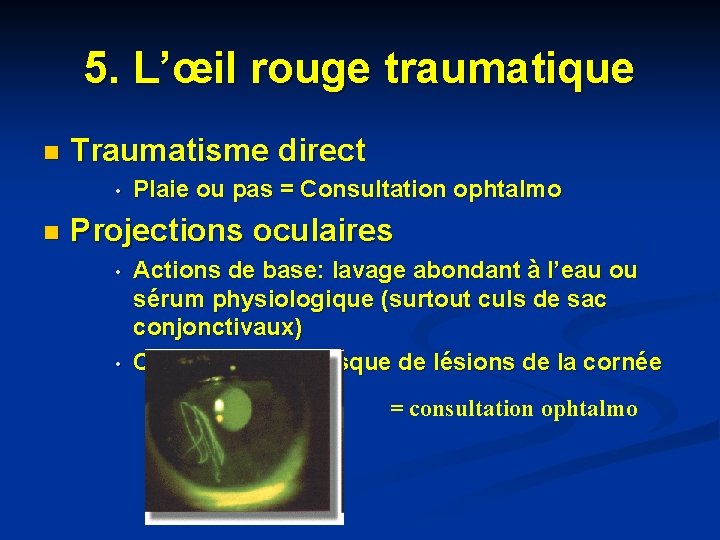 5. L’œil rouge traumatique n Traumatisme direct • n Plaie ou pas = Consultation 5. L’œil rouge traumatique n Traumatisme direct • n Plaie ou pas = Consultation