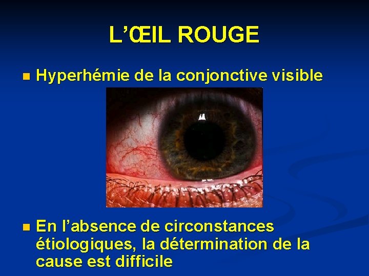 L’ŒIL ROUGE n Hyperhémie de la conjonctive visible n En l’absence de circonstances étiologiques, L’ŒIL ROUGE n Hyperhémie de la conjonctive visible n En l’absence de circonstances étiologiques,