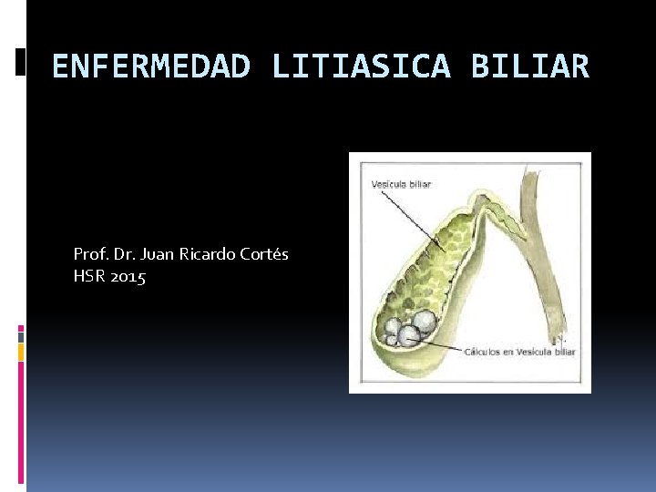 ENFERMEDAD LITIASICA BILIAR Prof. Dr. Juan Ricardo Cortés HSR 2015 