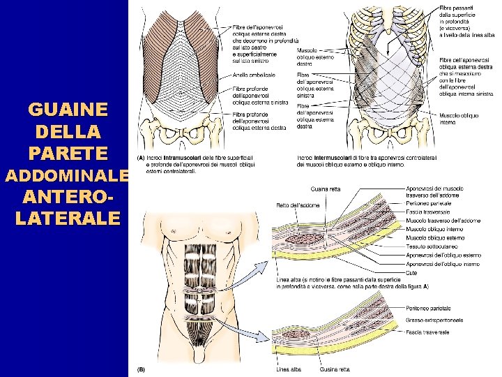 GUAINE DELLA PARETE ADDOMINALE ANTEROLATERALE 